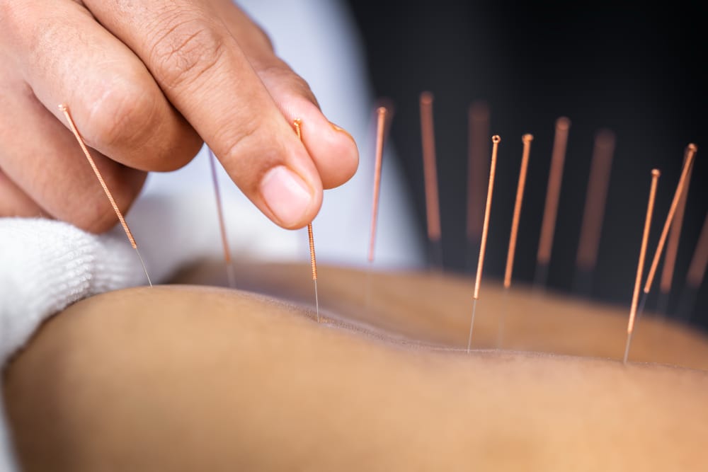 UCO Acupuncture Clinic